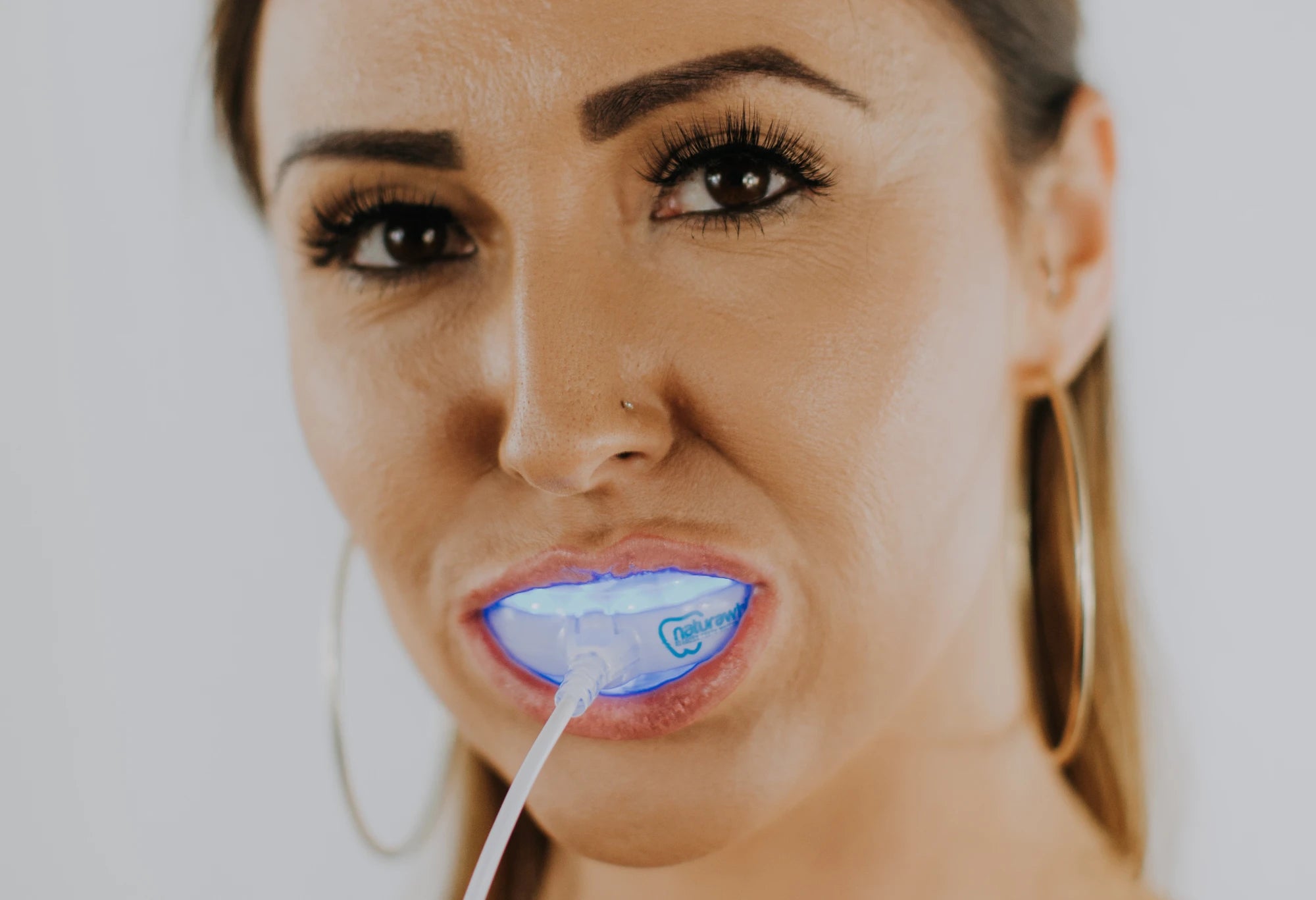 5 Things You Didn’t Know About Cosmetic Teeth Whitening